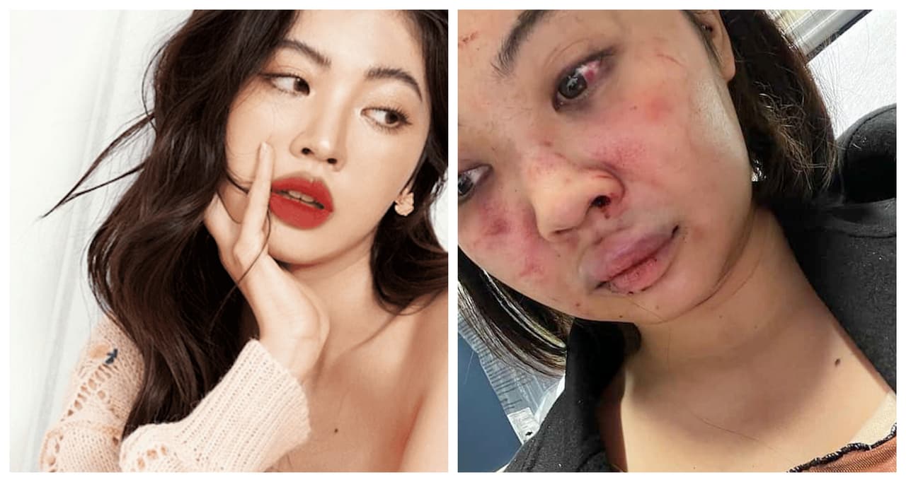 Tenía 44 arrestos antes de agredir física y sexualmente a esta modelo en el subway