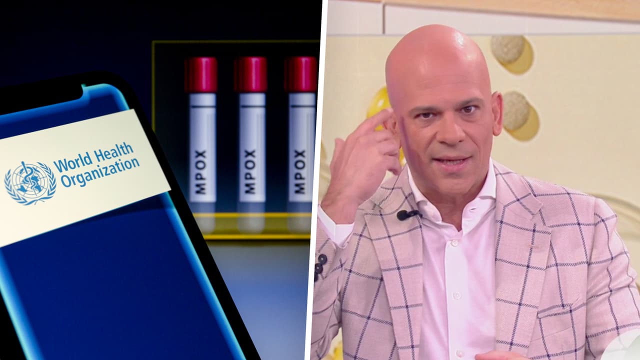 Viruela del mono: Dr. Juan explica qué es, cómo se contagia y si podría convertirse en una pandemia