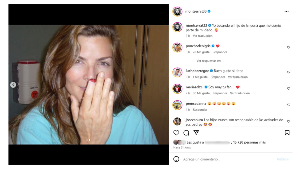 La presentadora muestra las secuelas de su encuentro con una leona en 2006.