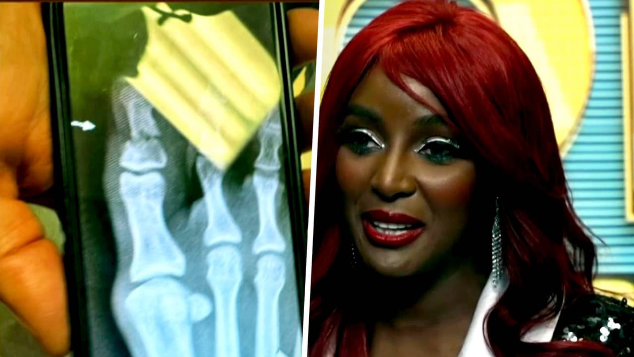 Amara 'La Negra' habla tras abandonar Mira Quién Baila ¡La Revancha! por una fractura en su dedo