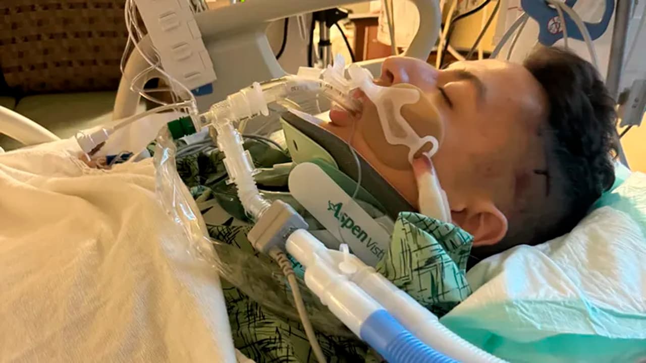 Christian Bedolla se encuentra en la unidad de cuidados intensivos.