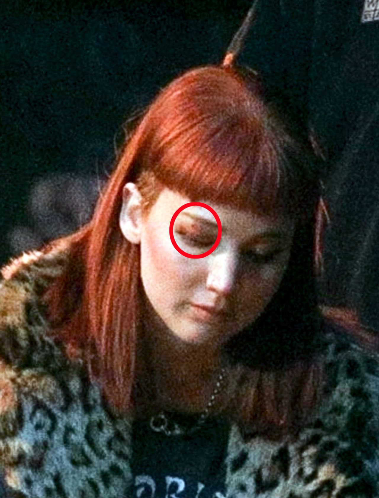 El cristal le cortó el párpado derecho.