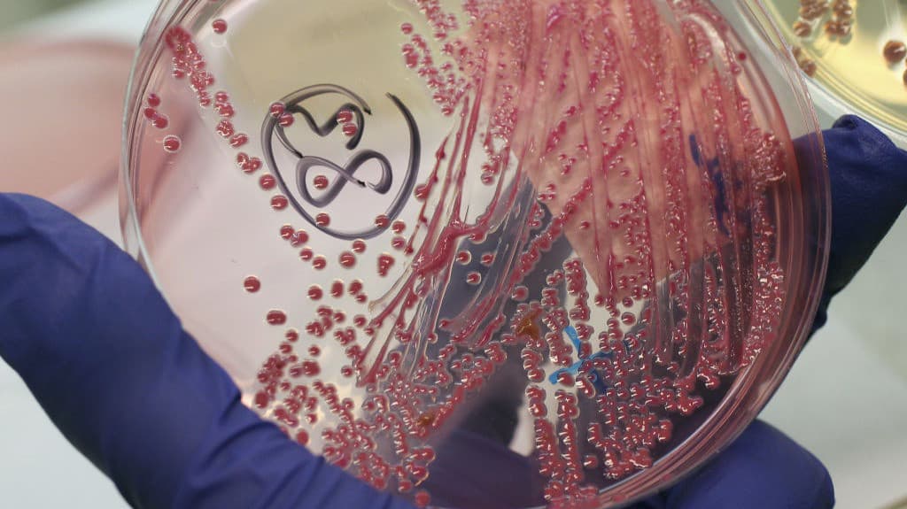 Alertan sobre primer caso positivo de bacteria "come carne' en Pensilvania: esto es lo que se sabe 