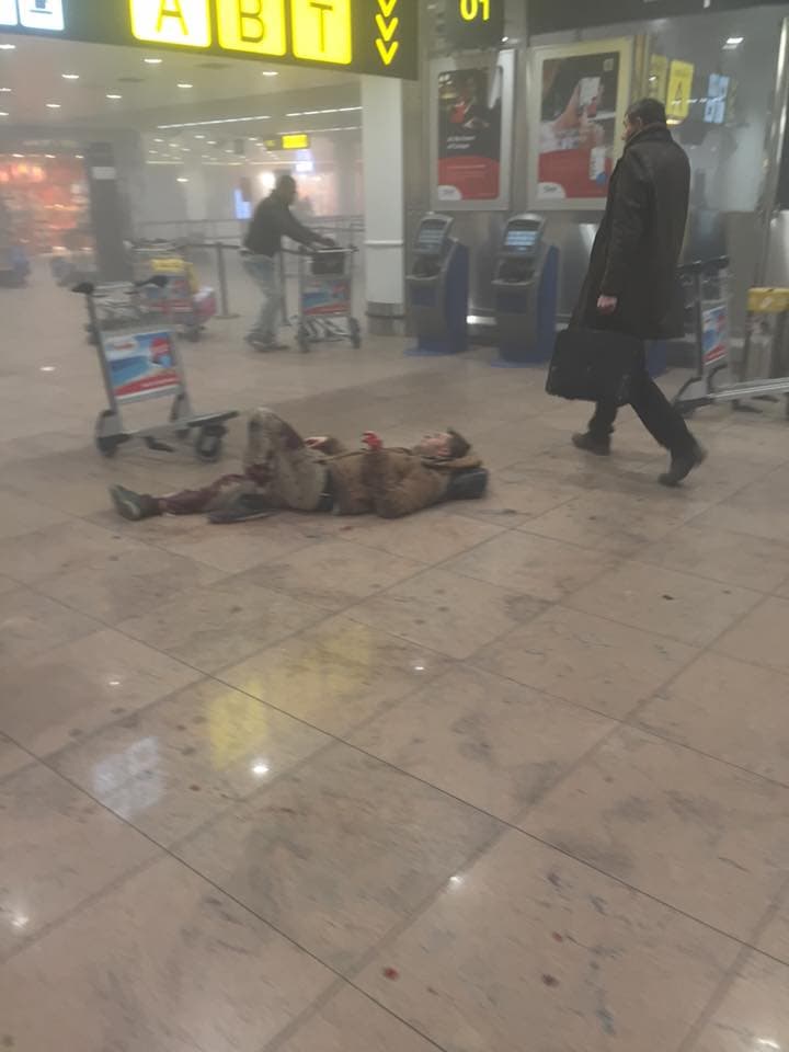 Un hombre yace herido en el aeropuerto de Bruselas. Foto provista por Ketevan Kardava vía AP.