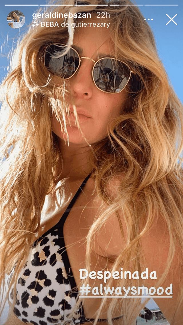 Salvo los descansos que debe tomar después de cierto tiempo de caminar, la lesión no impide que la actriz goce de sus vacaciones. 
<br>