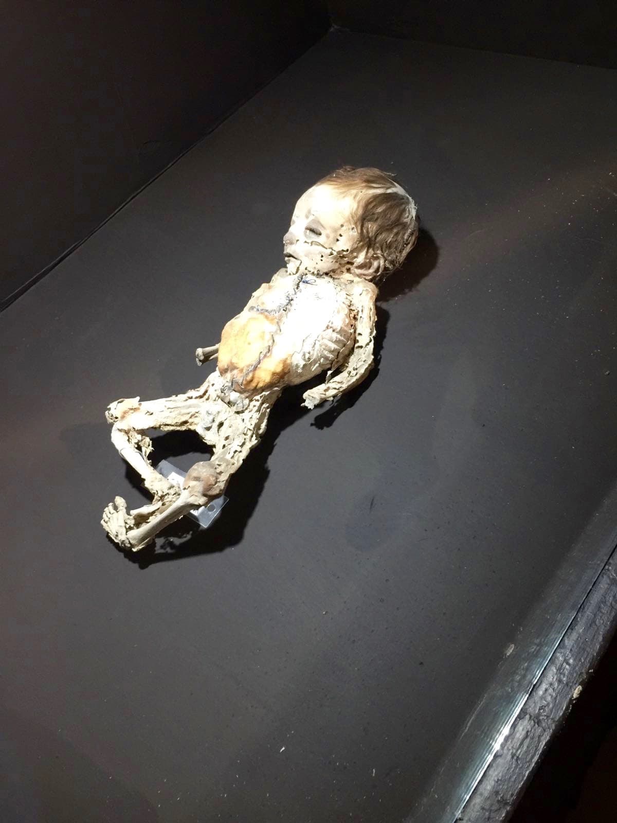 Ahí se encuentra la momia más pequeña del mundo: un feto de una mujer que murió víctima de cólera.