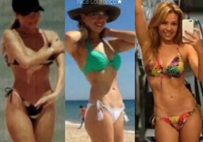 El sólo hecho de quitarse un par de costillas podría ser muy peligroso para cualquier persona, pues la caja torácica quedaría muy expuesta y si 'Thalis' sufriera un accidente sería muy grave.