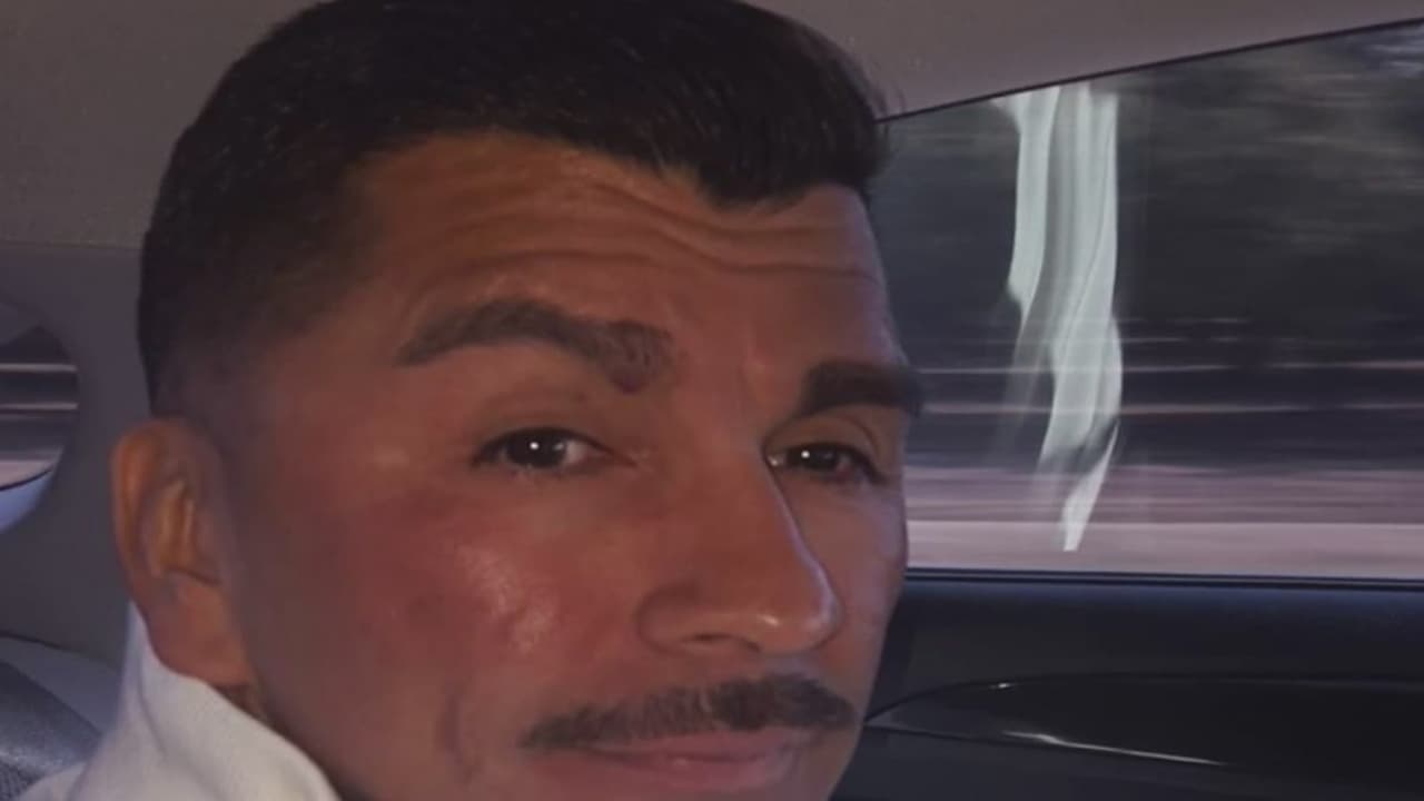 Balean a hombre de Fresno tras un supuesto altercado con los sospechosos