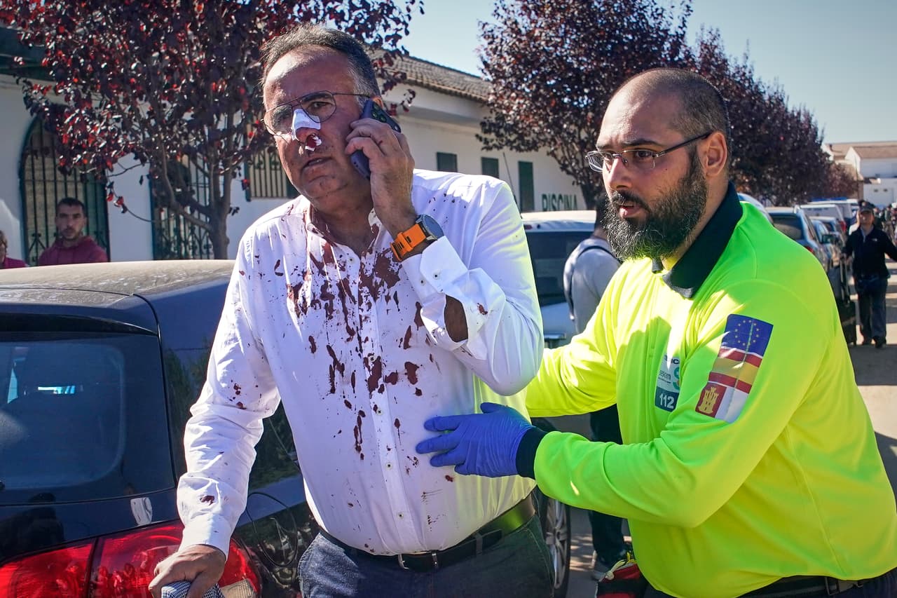 Uno de los pasajeros rescatados presenta heridas en el rostro.