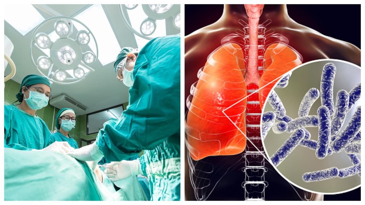 Muere una segunda persona por brote de legionario en El Bronx; ya son 24 los casos confirmados
