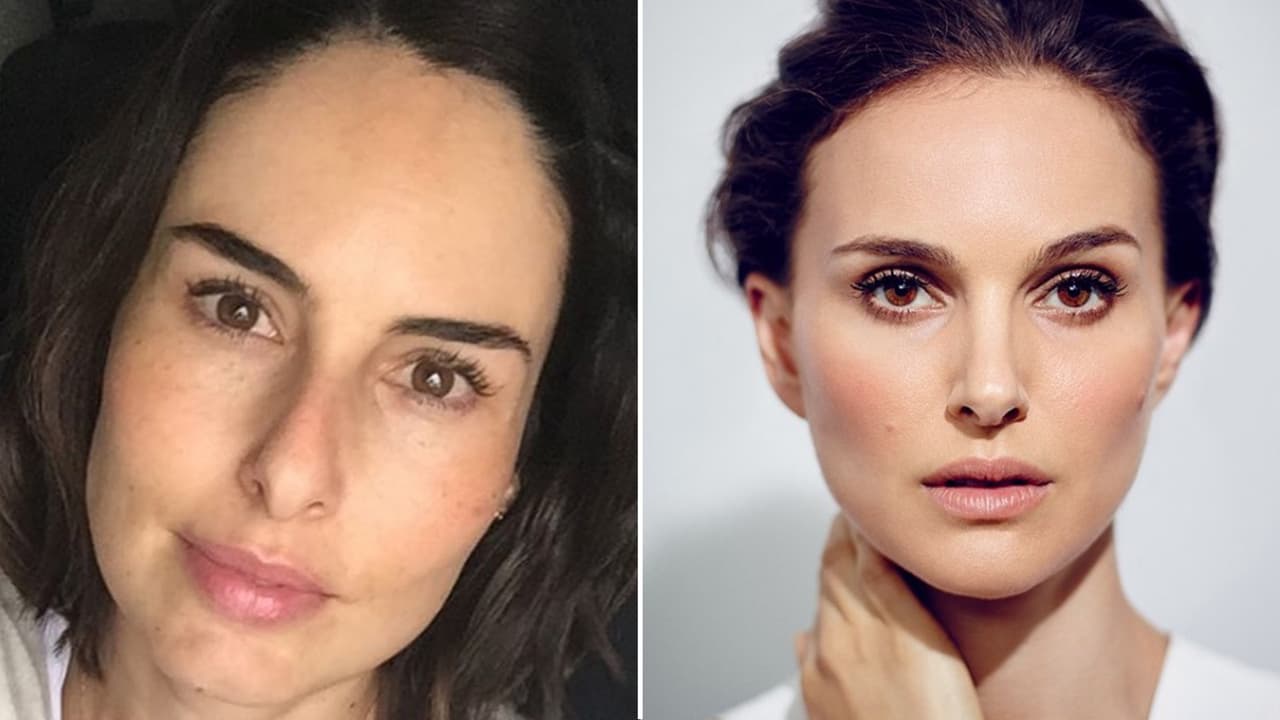 Las semejanzas quedan a la vista de todos.