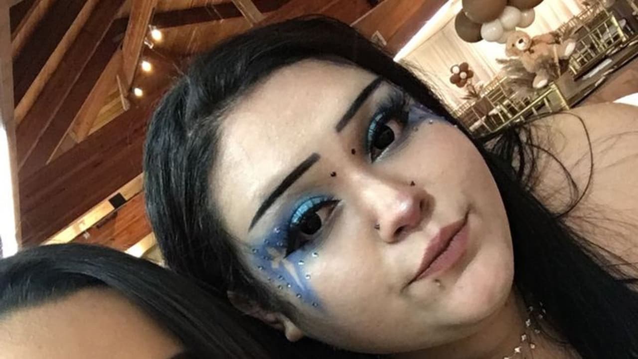 La dieron por muerta: Hispana se recupera tras ser atropellada por un conductor que escapó