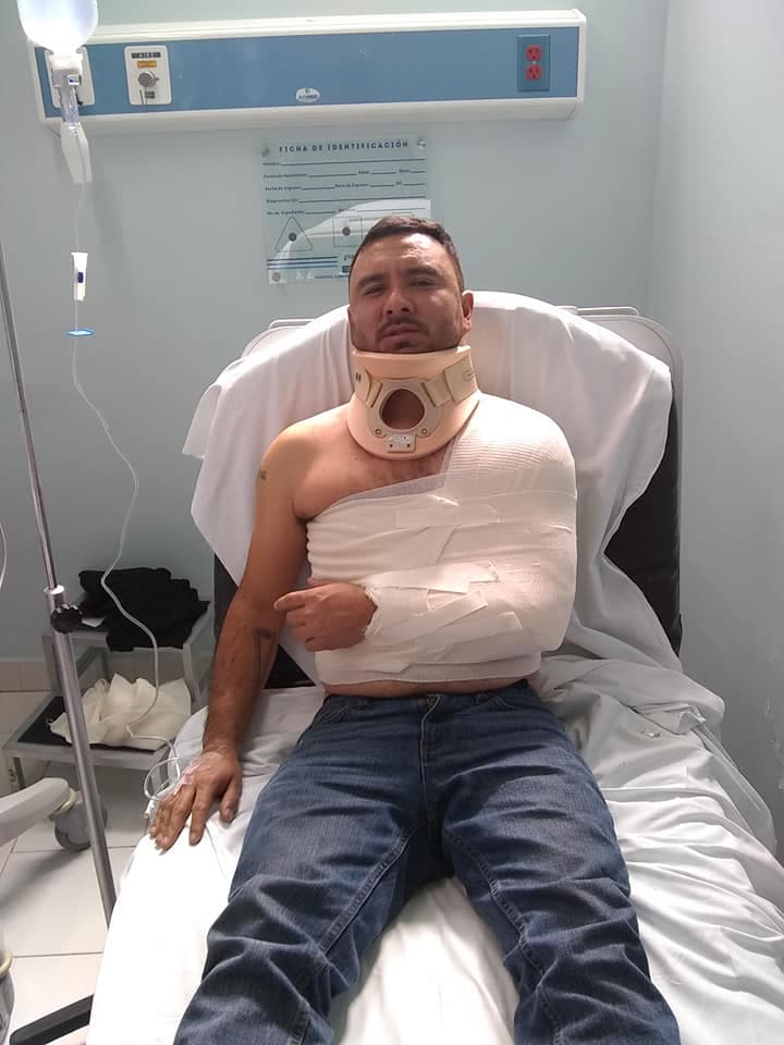 Marcos Garza, mejor conocido como 'El Pollo', resultó con una dislocación del hombro izquierdo.