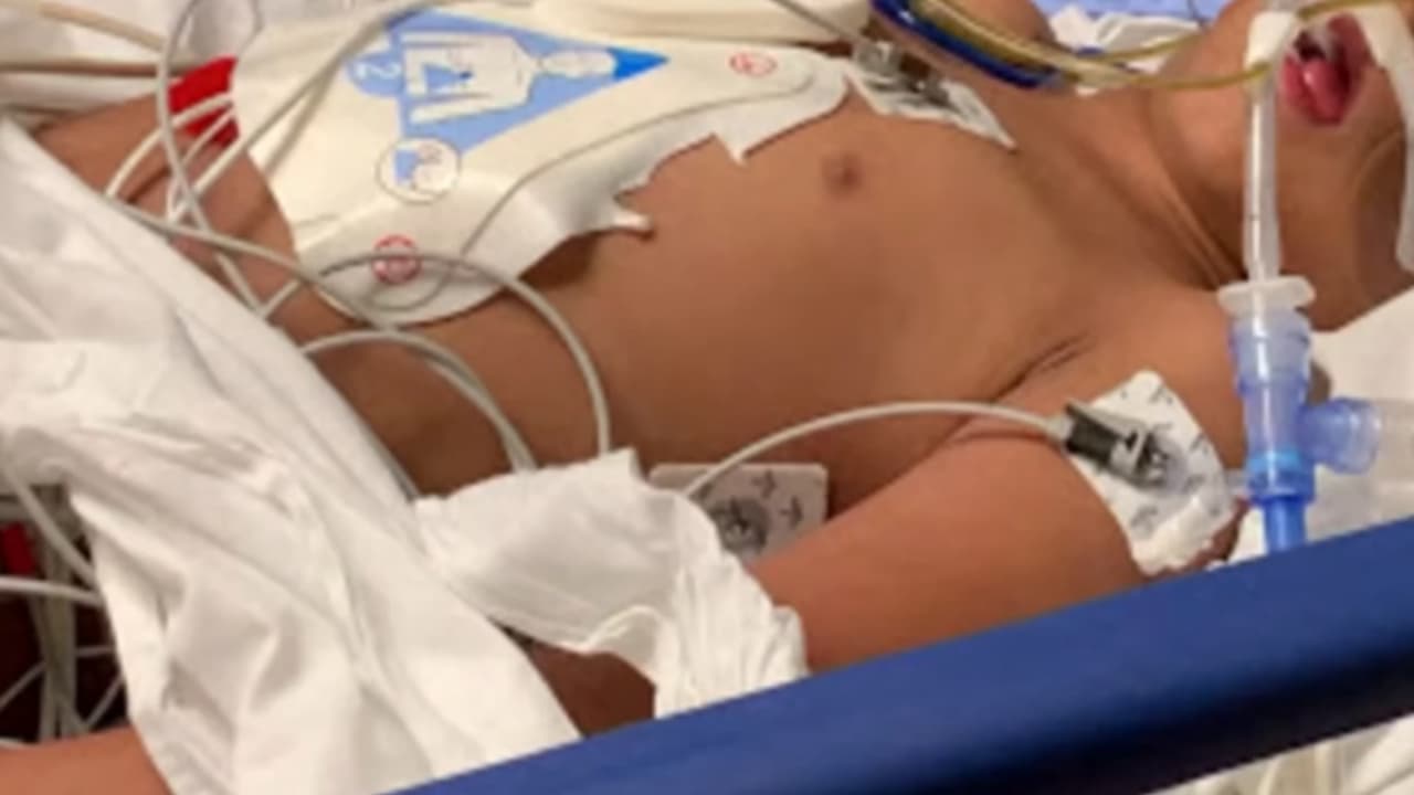 “Es una reacción inmunológica que produce inflamación de las arterias pequeñas del cuerpo”, explicó la doctora Aileen Marty, especialista infectóloga de FIU.
<br>