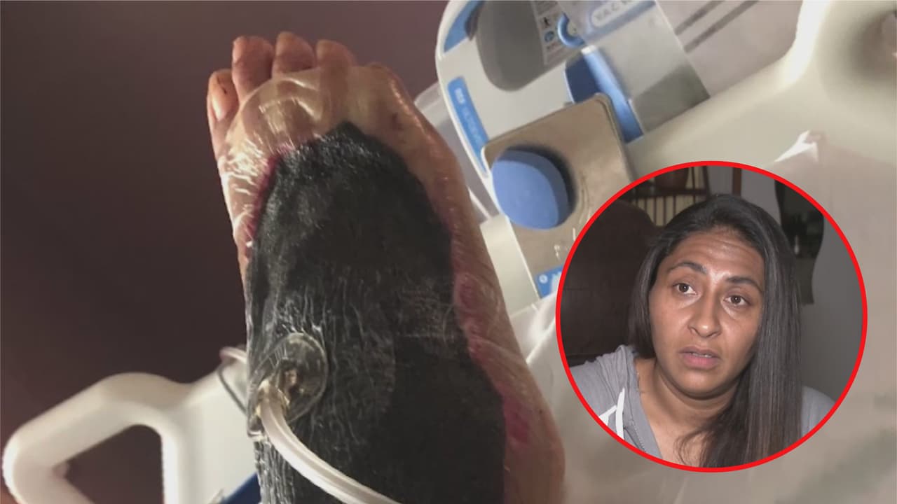 Lou Brigitte Huerta contó a Univision 45 que está consciente de que su recuperación será larga y lenta.