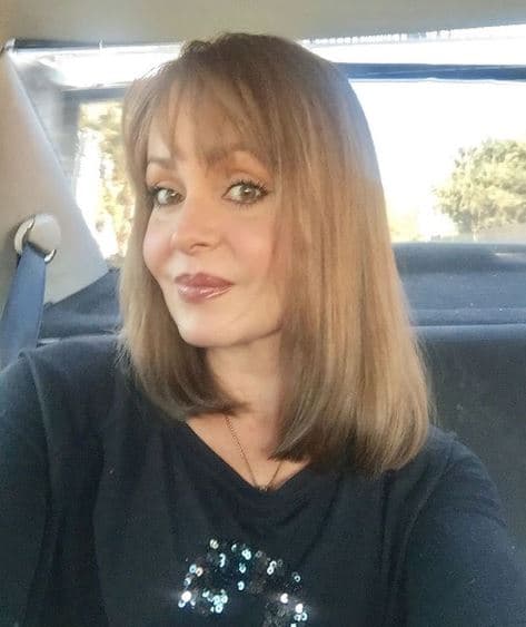 El tratamiento al que la protagonista de 'La Usurpadora' se sometió consistió en una base de botox, mismo que ella documentó en sus historias de Instagram.