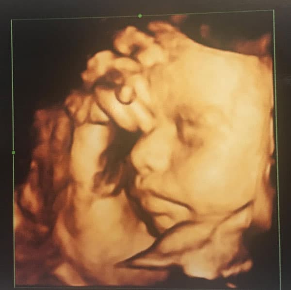 Así presentó a su bebita por primera vez: "Mi Niña#AitanaAguirreDeSaracho 👑🎀💞".