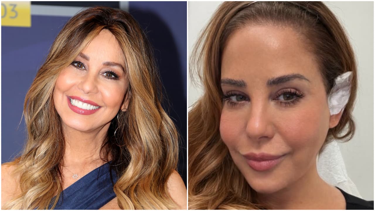 Myrka Dellanos es diagnosticada con cáncer y sometida a cirugía: "Infiltró la oreja y el oído”