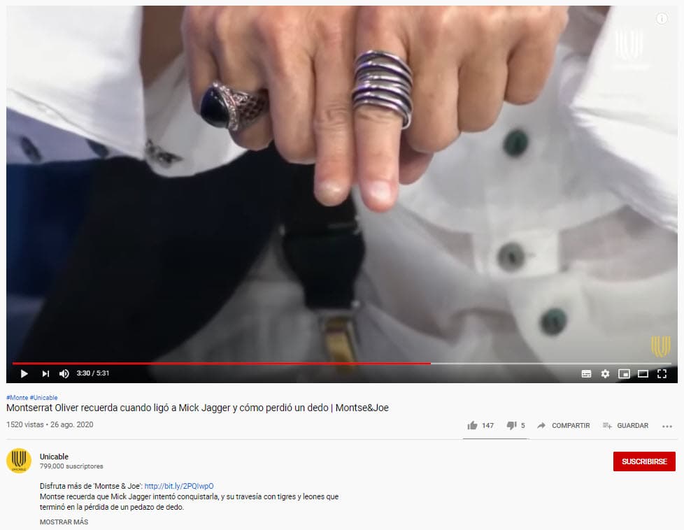 "
<b>Me comió un dedo, pero fue un león, me arrancó un pedazo</b> […] Fue la puntita", dijo acerca del momento que vivió en 2006 mientras mostraba su mano.