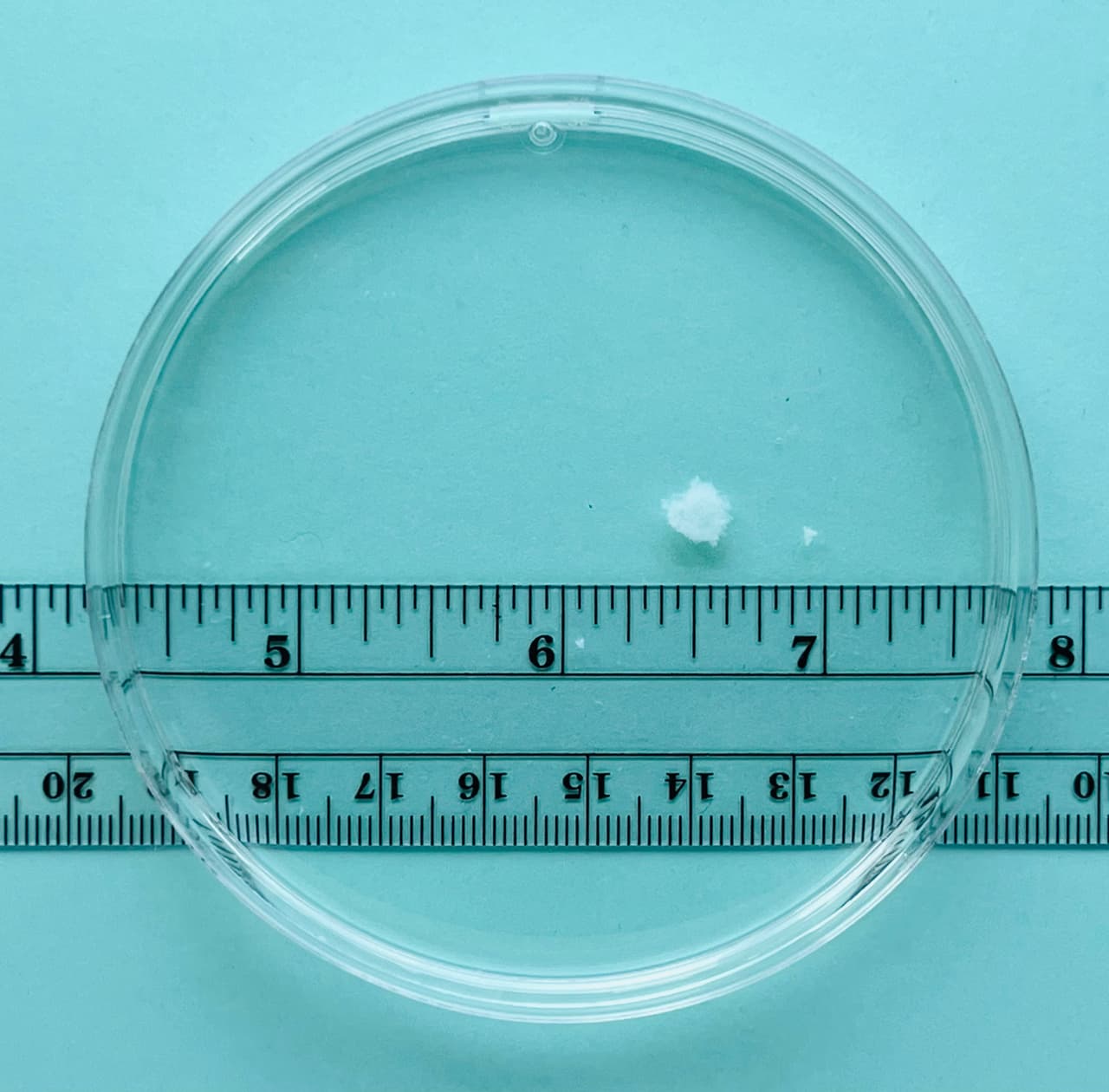 <b>Semana cinco del embarazo.</b> A veces, las pacientes quieren ver el tejido 
<a href="https://www.univision.com/noticias/politica/corte-suprema-deroga-roe-wade-derecho-aborto">después de un aborto</a>. "Se quedan asombradas por su aspecto real", dice Fleischman en declaraciones a 
<i>The Guardian.</i> "Al principio me di cuenta de hasta qué punto las imágenes de internet y de las pancartas, que muestran cualidades similares a las del ser humano en esta fase temprana del desarrollo, han calado en la cultura". Cuando se extrae este tejido durante un procedimiento en el consultorio, también se ve parte del revestimiento menstrual (llamado decidua) y algo de sangre.