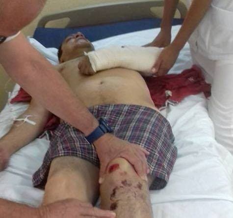 El líder de la agrupación originaria del estado de Veracruz, Roberto Bueno, también resultó gravemente herido en el accidente, así como otros integrantes de la banda de tropical mexicano.