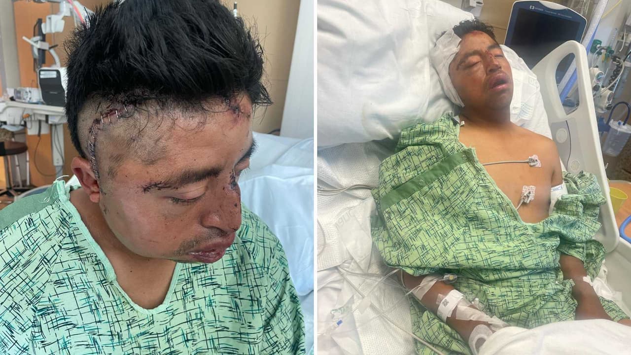 Un jardinero guatemalteco de 29 años se encuentra en estado crítico tras haber sido víctima de un violento robo a mano armada el sábado 15 de junio en Oakland, una ciudad donde ya se han reportado más de 1,700 asaltos agravados y más de 4,000 robos en lo que va del año.