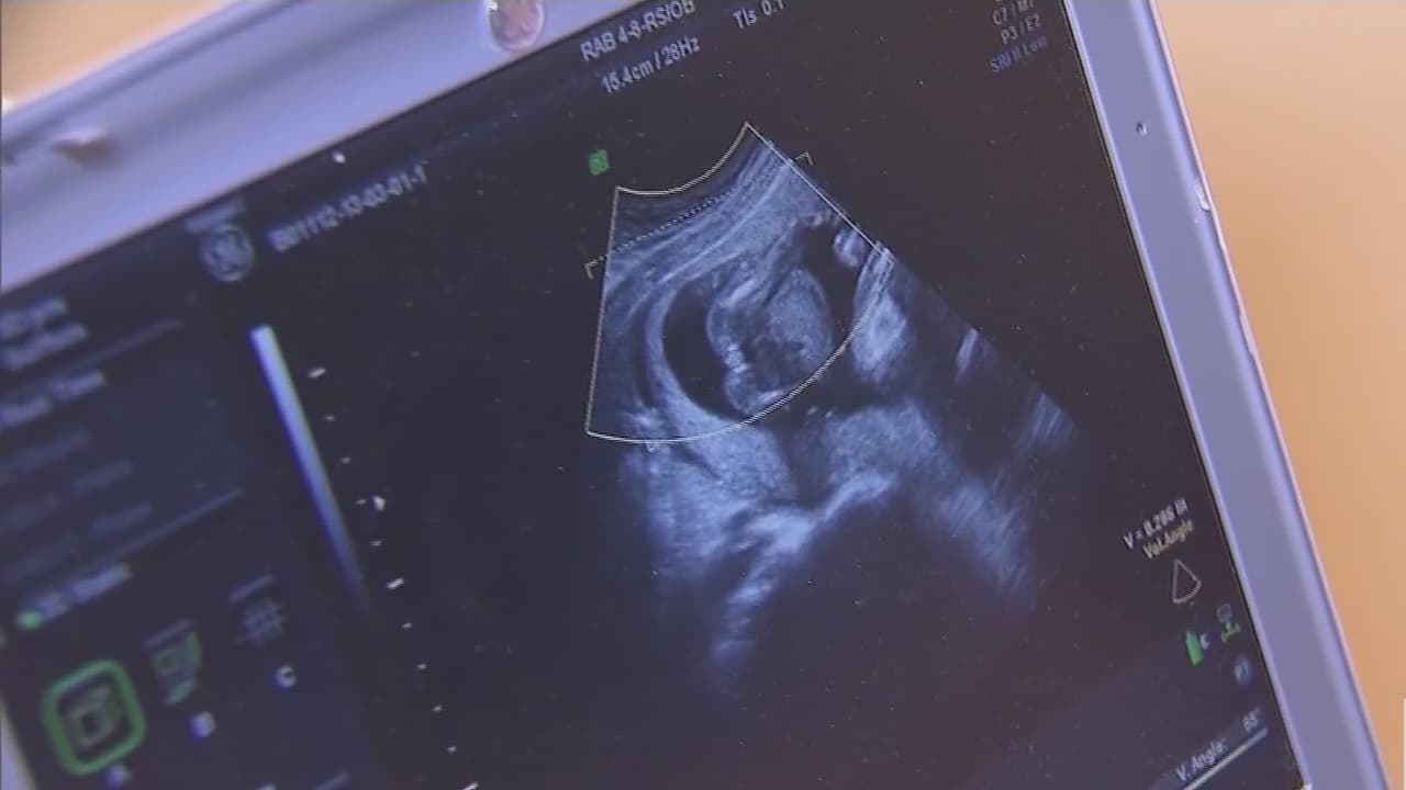 Montgomery asigna $1 millón para centros de servicios reproductivos, incluido el aborto