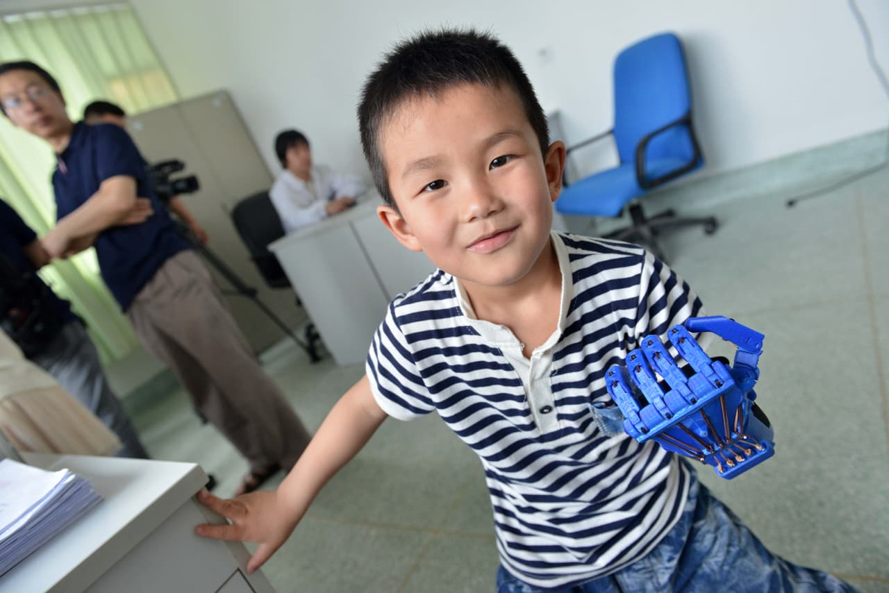 Ahora tiene un mano nueva con la que tendrá una mejor calidad de vida.