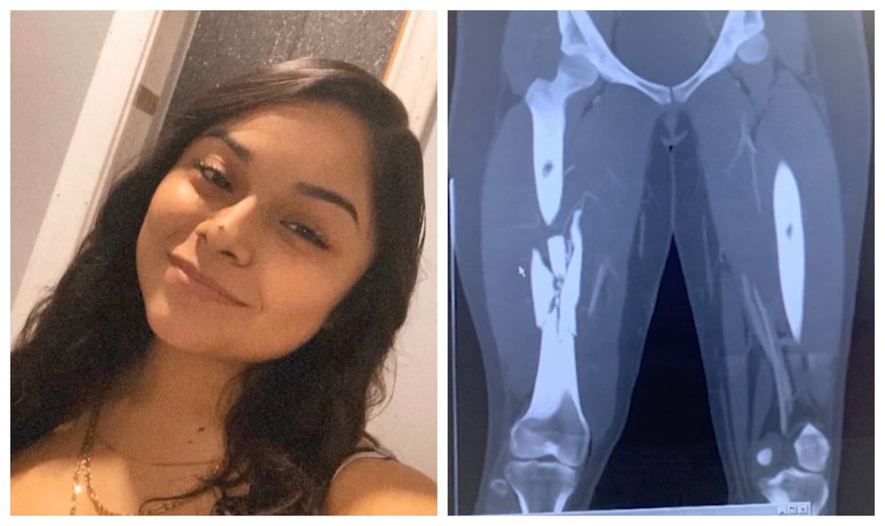 “Me gritaba que me amaba”: Madre de víctima de tiroteo en Austin narra el daño físico y mental que sufrió su hija 