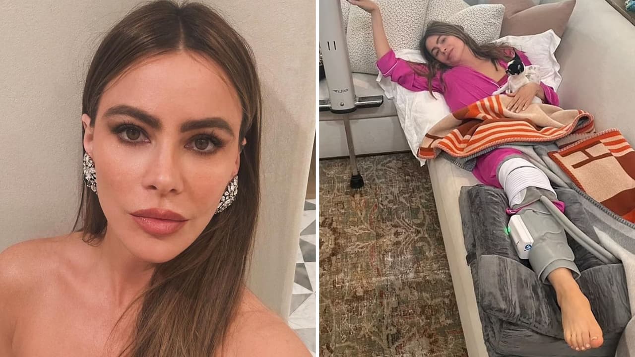 Sofía Vergara muestra la cicatriz en su “pata mocha” tras someterse a una “cirugía mayor”