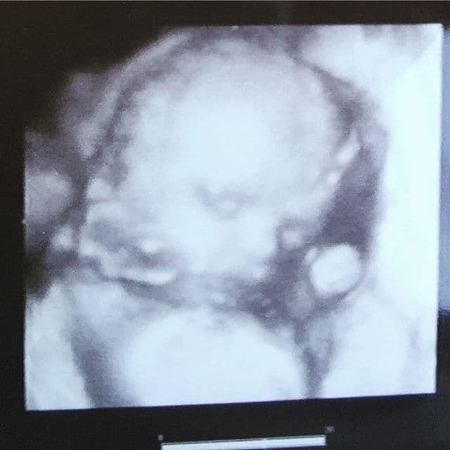 Ya está a nada de dar a luz a su pequeña Gia.