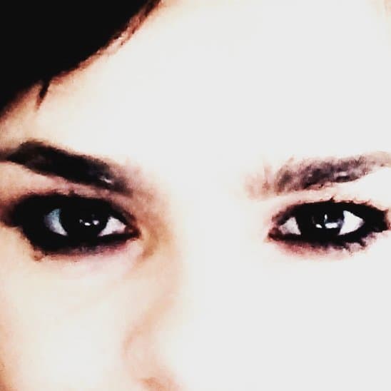 Sin embargo, Francesca dijo que en ese momento sí inició un tratamiento para extirpar el tejido dañado.