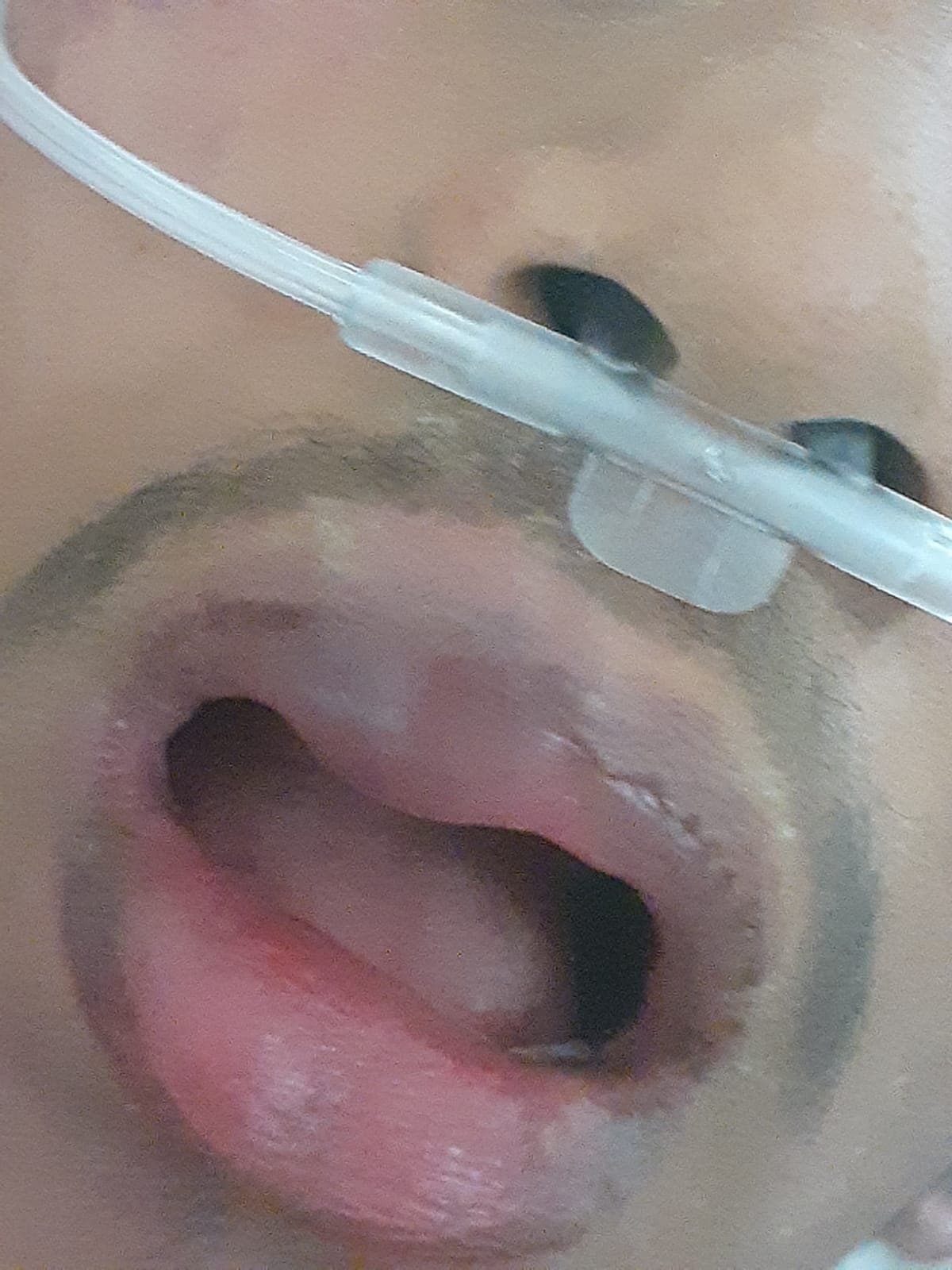 Estudiante lesionado terminó en el hospital, tras una pelea escolar.