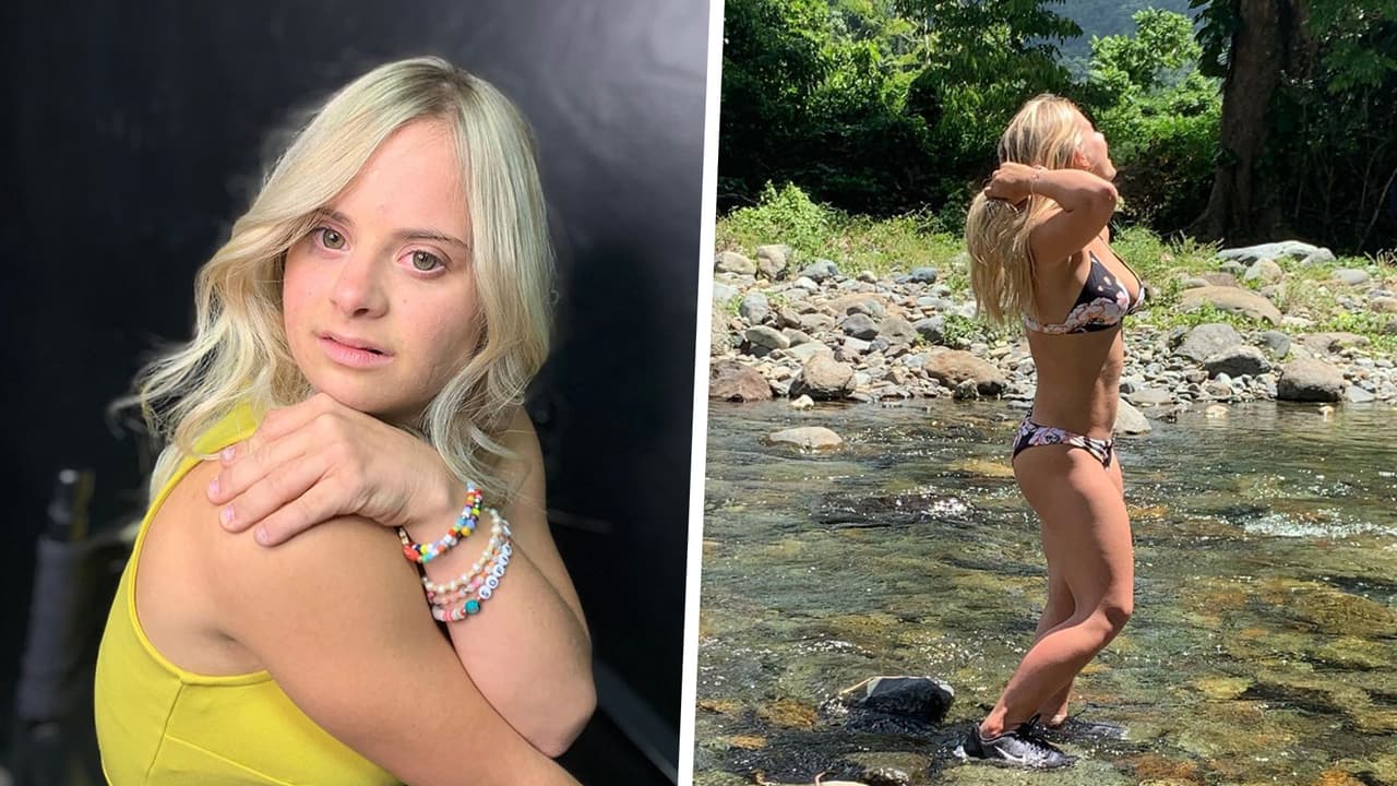 Madre de modelo con síndrome de down, revela que médicos le dijeron que la regalara al nacer