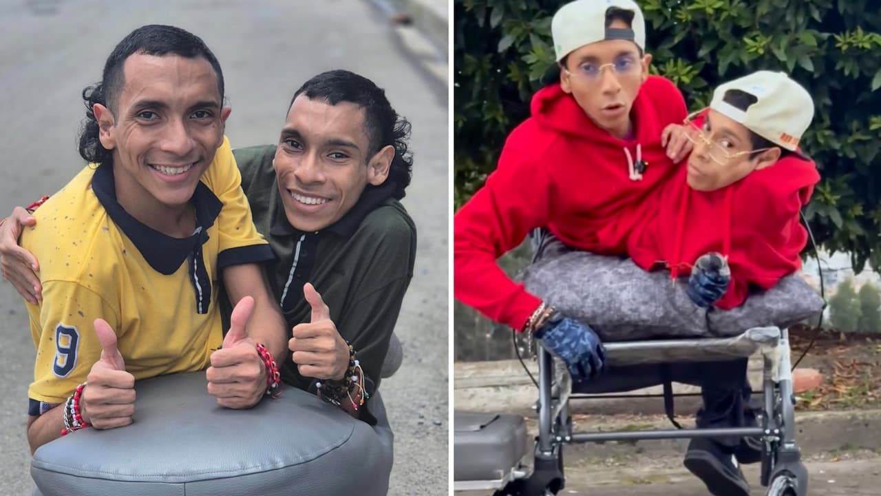 Los Siameses del Ecuador tenían planes de boda: se enamoraron de la misma mujer