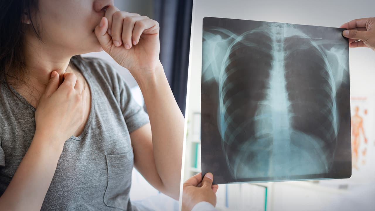 “La tos es un reflejo para sacar sustancias nocivas del cuerpo, como las flemas que puedes tener cuando tienes algún problema”, dijo el Dr. Joseph Varón, del United Memorial Medical Center.