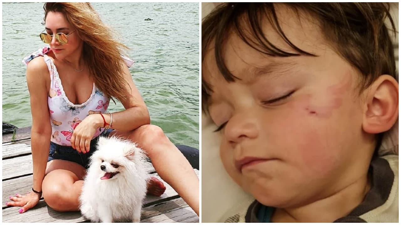 Sherlyn responde a quienes la llaman "mala mamá" por defender a su perro tras morder a su hijo