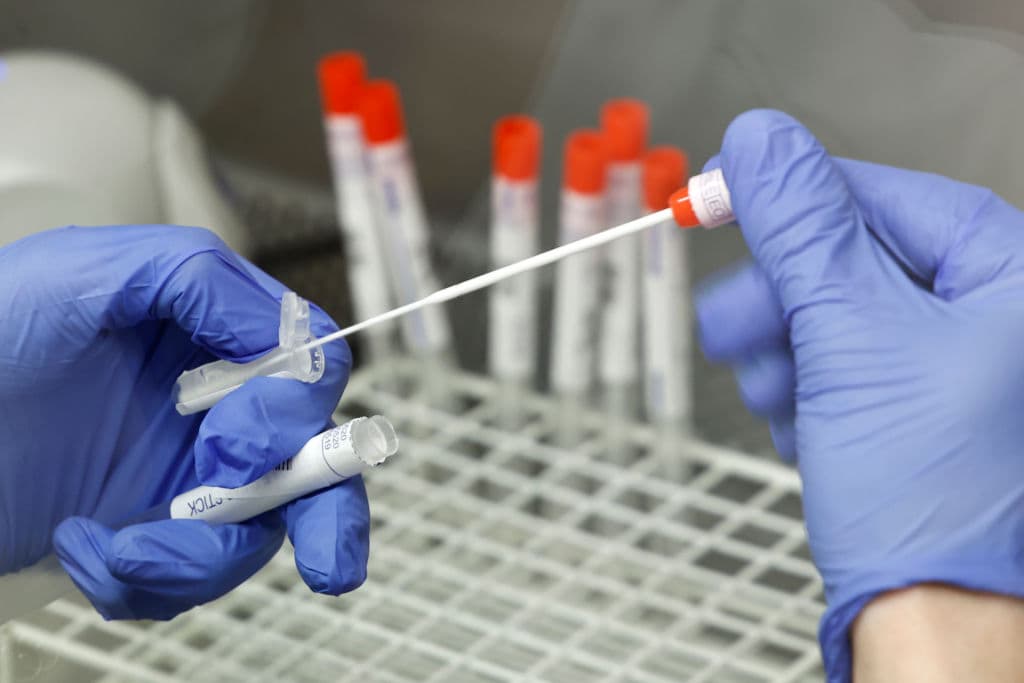 La variante Lambda del coronavirus ya llegó a Texas, ¿representa una amenaza similar a Delta?