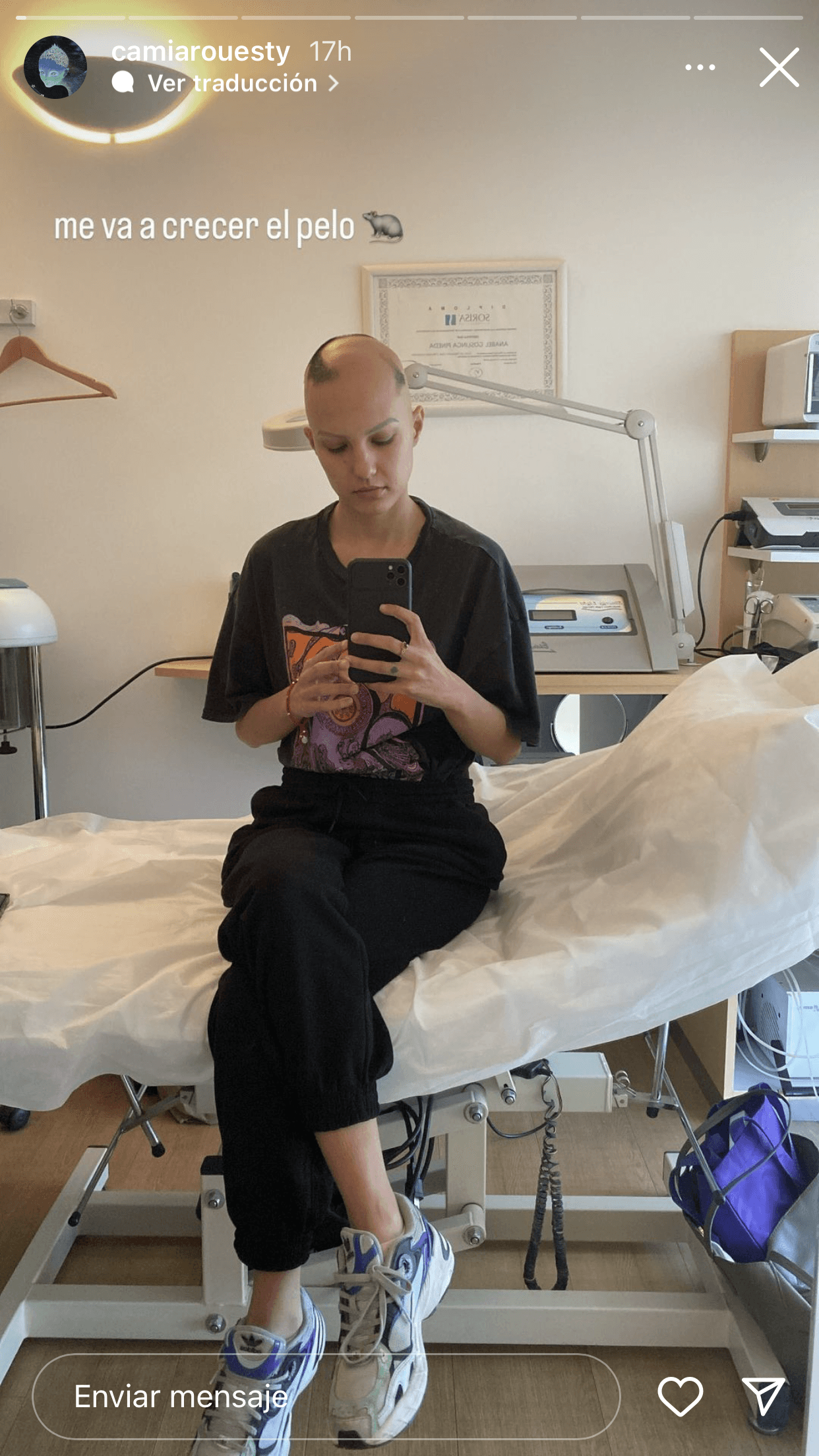 Sin embargo, recientemente anunció que se someterá a un nuevo tratamiento para este padecimiento dermatológico, con la esperanza de que le vuela a "crecer el pelo".