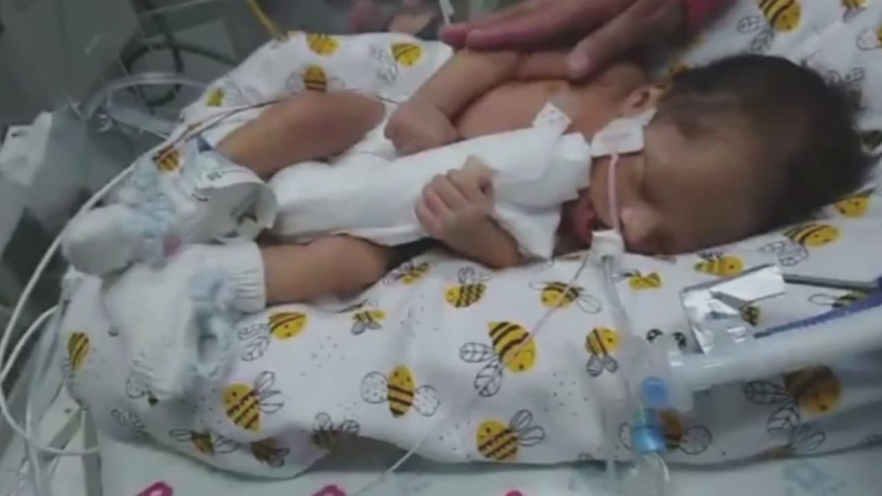 El niño había sido declarado con muerte cerebral, pero en un punto del tratamiento abrió los ojos, lo que dio esperanza a la familia. No obstante, luego de un mes de aferrarse a la vida, el pequeño perdió la vida.