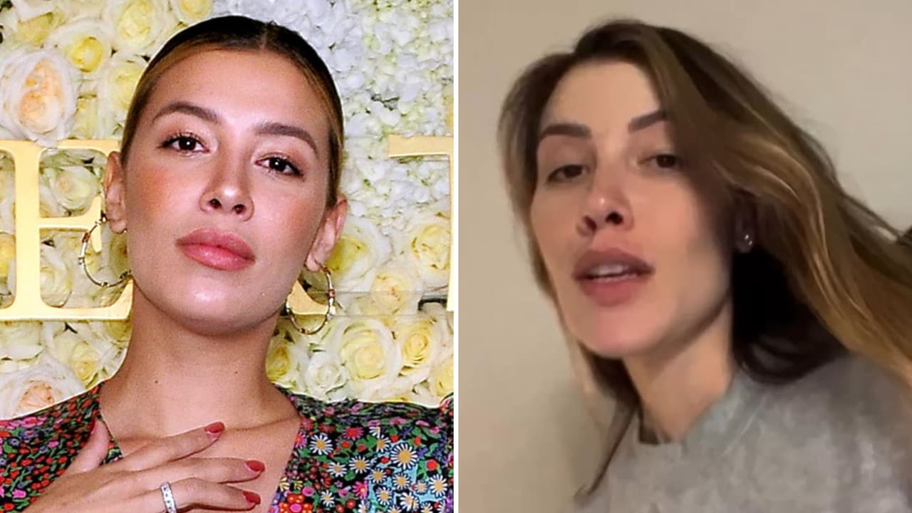 Michelle Salas revela “grave problema” por el que atraviesa y pide ayuda: “Me duele el cerebro”