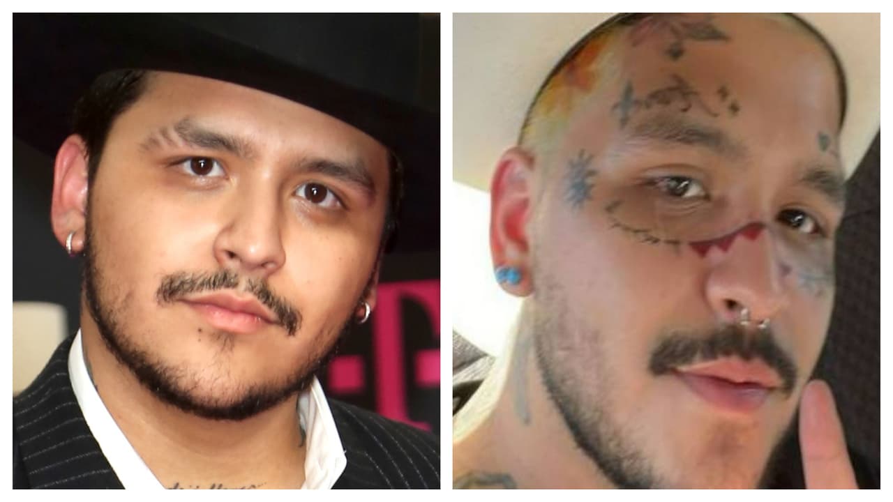 Pero la incógnita sigue en el aire: ¿qué pasó? ¿Realmente se los quitó o solo se trata de un video añejo antes de que se los hiciera?