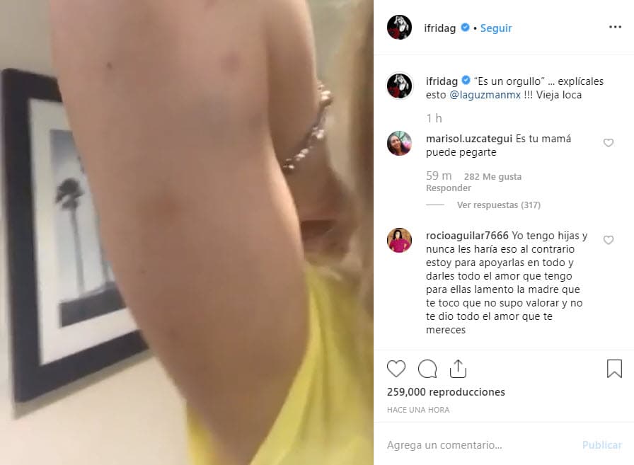 En otro video publicado en su cuenta de Instagram, Frida mostró los 
<b><a href="https://www.univision.com/famosos/frida-sofia-se-muestra-en-un-video-con-moretones-y-acusa-de-maltrato-fisico-a-su-madre-alejandra-guzman-video">supuestos moretones</a></b> que alguna vez le provocaron los golpes de su madre: "'Es un orgullo'... explícales esto @laguzmanmx. Vieja loca", se lee en el mensaje.