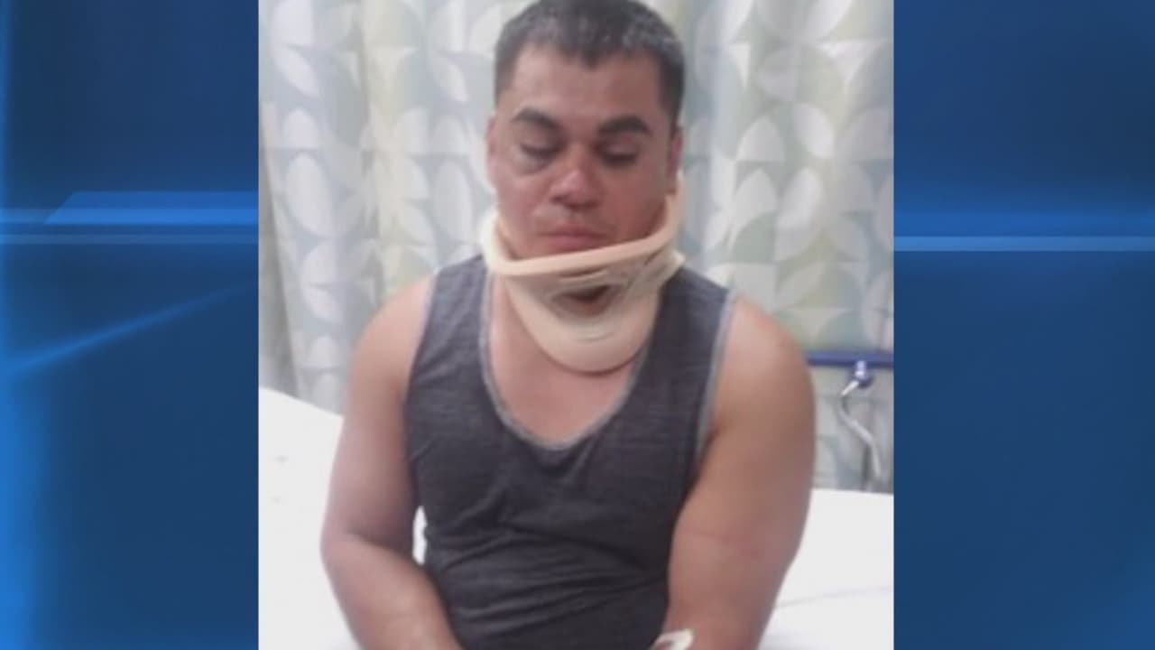 "Eres mexicano, no te queremos aquí", afirma que le gritaron hombre golpeado en un parque de Staten Island