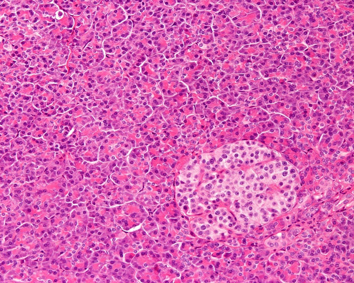 Cada uno de estos parches (llamados islotes) contiene células beta, alfa y delta que son responsables de la secreción de hormonas pancreáticas.
<a href="https://www.britannica.com/science/islets-of-Langerhans#ref196868" target="_blank">Las células beta secretan insulina</a>, hormona crucial en la regulación del metabolismo de la glucosa. En la foto, ampliación de un islote de Langerhans, esas células diferenciadas del páncreas.
<br>