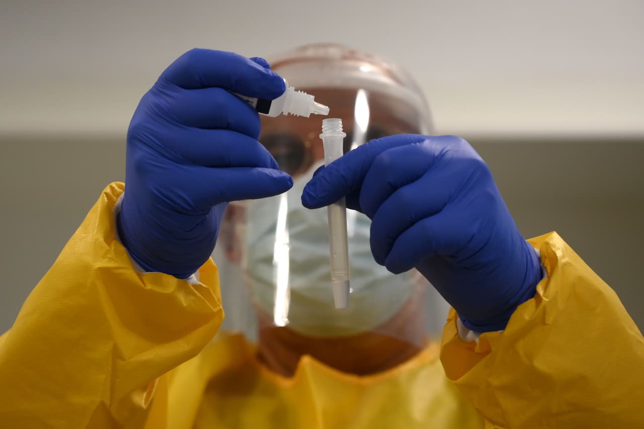 Esto es lo que sabemos hasta ahora de la reinfección por coronavirus