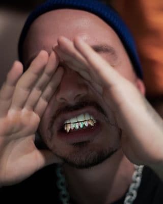 No menos doloroso ha sido el trabajo de "grillz" que ahora comenzó a hacerse en los dientes. Algunos consideran que estas cubiertas odontológicas son una especie de tatuaje bucal. Y son bastante caros: 
<a href="https://www.tmz.com/2018/02/25/j-balvin-flawless-grill-15k/" target="_blank">se dice</a> que el primer trabajo , que se hizo en 2018, con diamantes de 7 kilates, le habría costado unos $15,000.