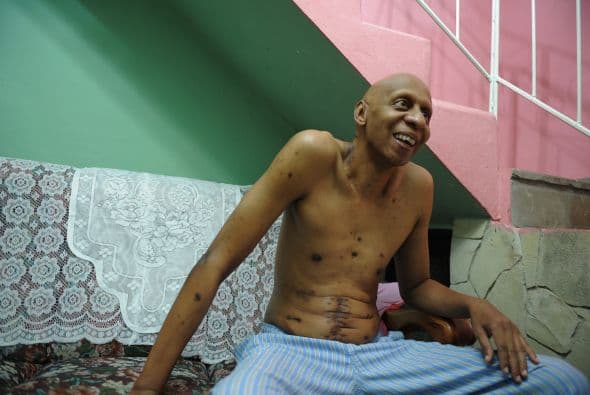 El disidente cubano Guillermo Fariñas, que acumula en su historial como opositor 23 huelgas de hambre contra el gobierno castrista, fue galardonado con el Premio Sajarov por el Parlamento Europeo.