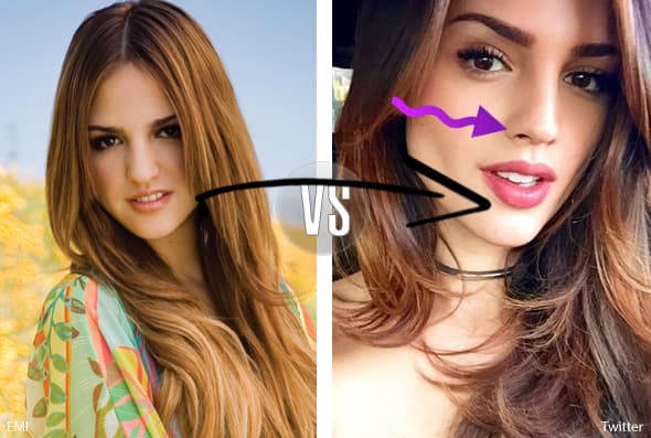 Pero después de ese primer paso, parece que vinieron más, pues ahora su cara se ve menos redonda, la nariz más afilada y los labios más carnosos gracias a colágeno.