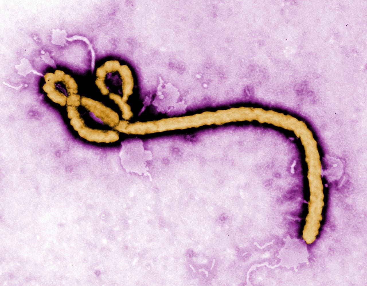 El 
<a href="https://www.univision.com/noticias/salud/preguntas-mas-frecuentes-sobre-el-virus-de-ebola">ébola</a> se transmite por los fluidos corporales como la sangre, el sudor o el semen. Por eso sin medidas de protección puede propagarse rápidamente. No existe tratamiento efectivo contra él. Aproximadamente 50% de quienes contraen el virus mueren. Si se detecta temprano lo único que se puede hacer es hidratar bien a la persona y tratar las infecciones secundarias que surjan.
<br>